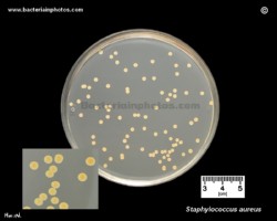 pigment in S.aureus, yellow colored colonies of staph aureus